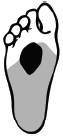 Metatarsal Pad